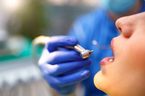 Dental Bonding in Springfield, NJ